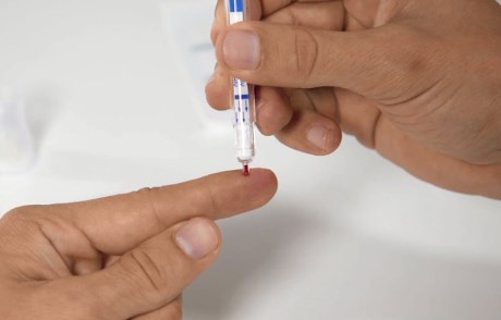 Blutprobe vom Finger