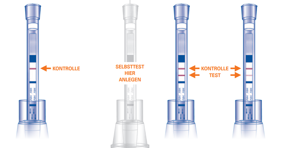 Abbildung für das Testergebnis, wenn es positiv und wenn es negativ ausfällt