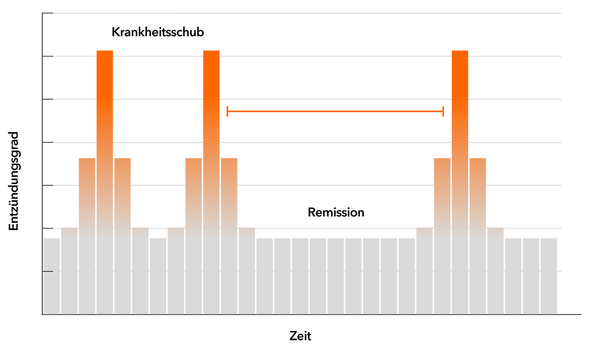 Grafik Verlaufsform der Erkrankung