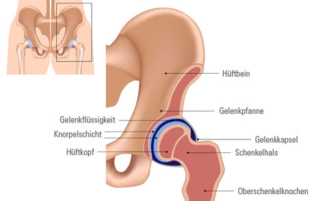 Hüfte Abbildung