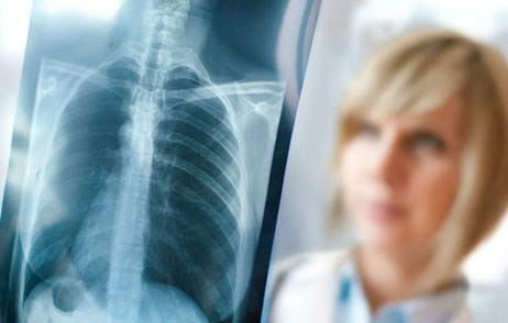 Ärztin betrachtet ein Röntgenbild von der Wirbelsäule
