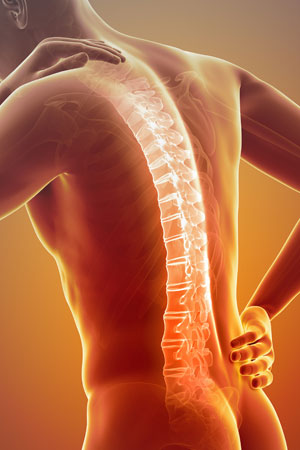 Bilddarstellung der Wirbelsäule mit Schmerzbereichen