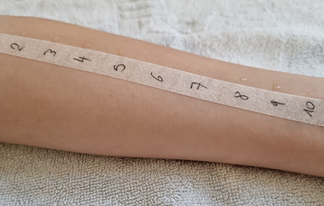 Pricktest auf Oberarm