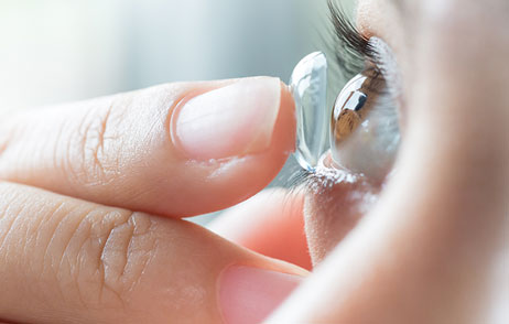 Trockene Augen Einsetzen einer Kontaktlinse ins Auge